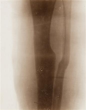 (X-RAYS) A small archive of 14 X-rays and related imagery documenting early use of the technology at Wesleyan University.